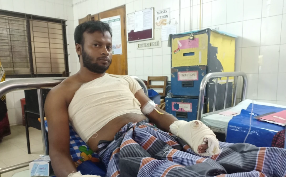 Burns and plastic surgery institute creates hope for Bangladeshi patients