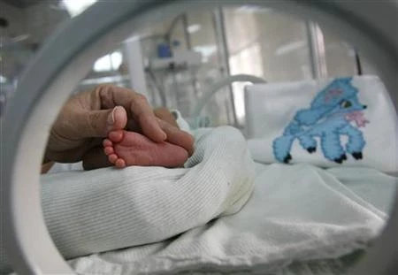 11 more cases of babies born with deformed arms in France