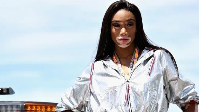 Winne Harlow shared the magazine cover on Instagram. (File photo: AFP)