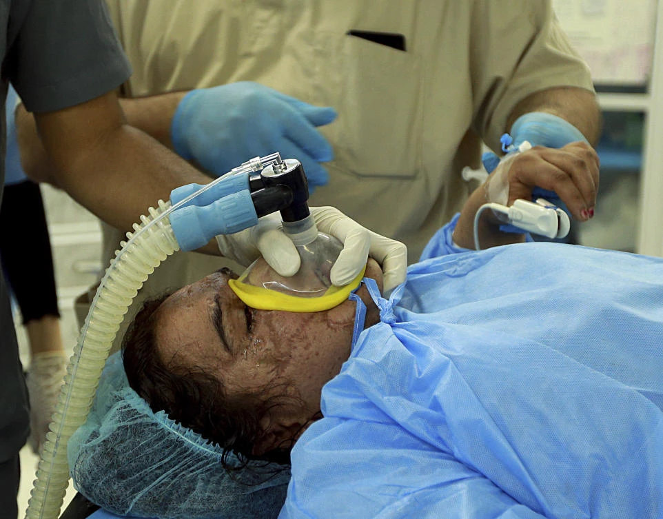 Saja Ahmed Saleem, is seen in the operating room for her reconstructive surgery, in Baghdad, Iraq. (AP Photo/Hadi Mizban)