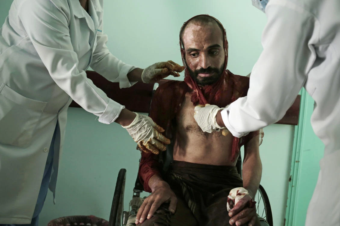 Ex-captives describe horrific torture by Houthi militia