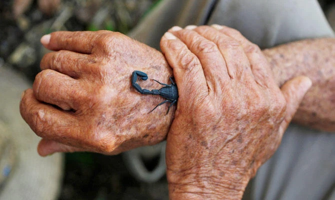 Worth the sting: Cuba’s scorpion pain remedy