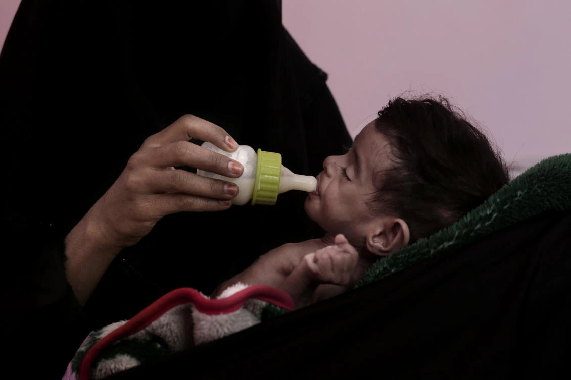 In this Feb. 13, 2018 file photo, Ahmed Rashid Mokbel, a severely malnourished 7-month-old Yemeni boy, is given formula by his mother at the Al-Sadaqa Hospital in Aden, Yemen. (AP)
