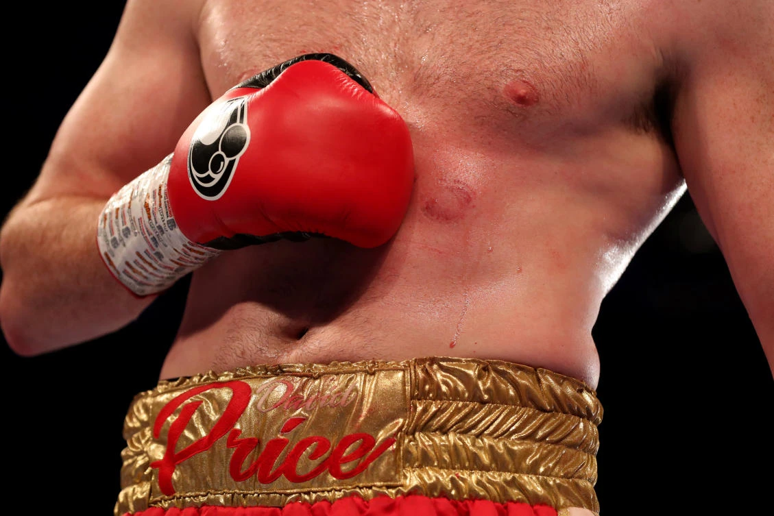 Boxer David Price reacts after being bitten by Kash Ali during their heavyweight fight on Saturday, March 30, 2019. (Action Images via Reuters)