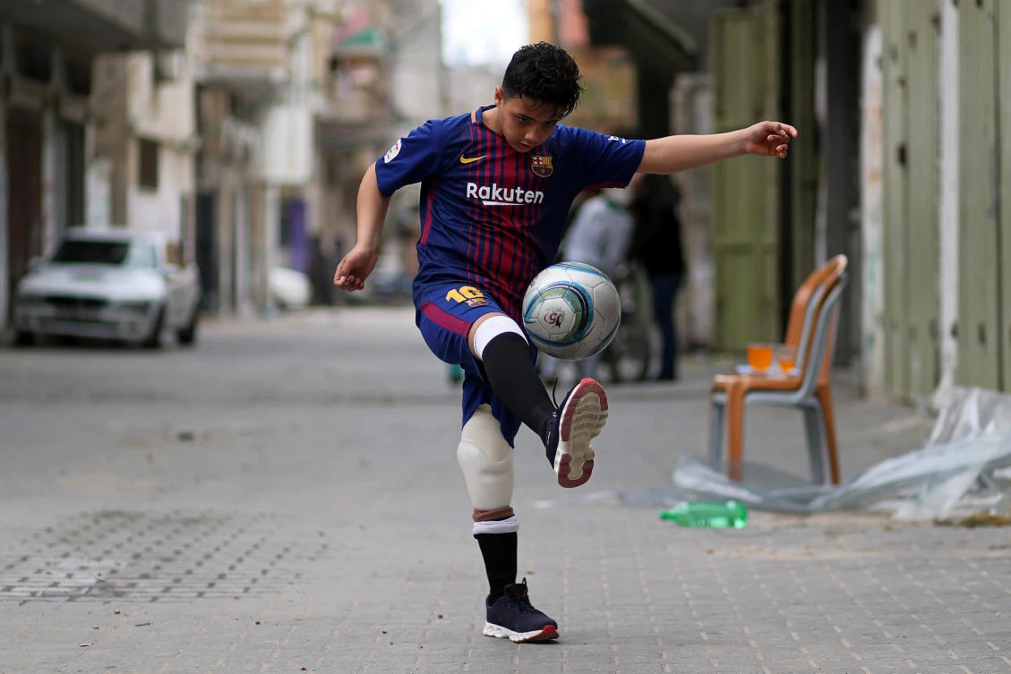 Artificial limbs change lives for wounded Gaza protesters