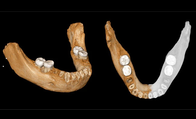 This combination of images provided by the Max Planck Institute for Evolutionary Anthropology, Leipzig shows two views of a virtual reconstruction of the Xiahe mandible. (Jean-Jacques Hublin, MPI-EVA, Leipzig)