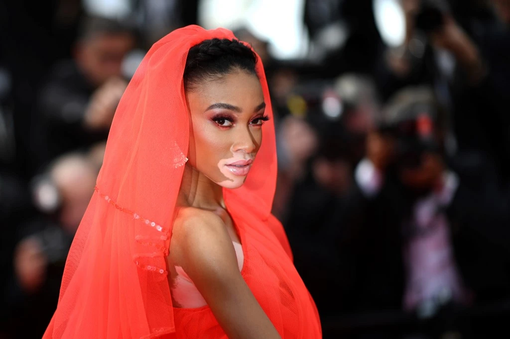 Winnie Harlow heads to Saudi Arabia for magazine photo shoot