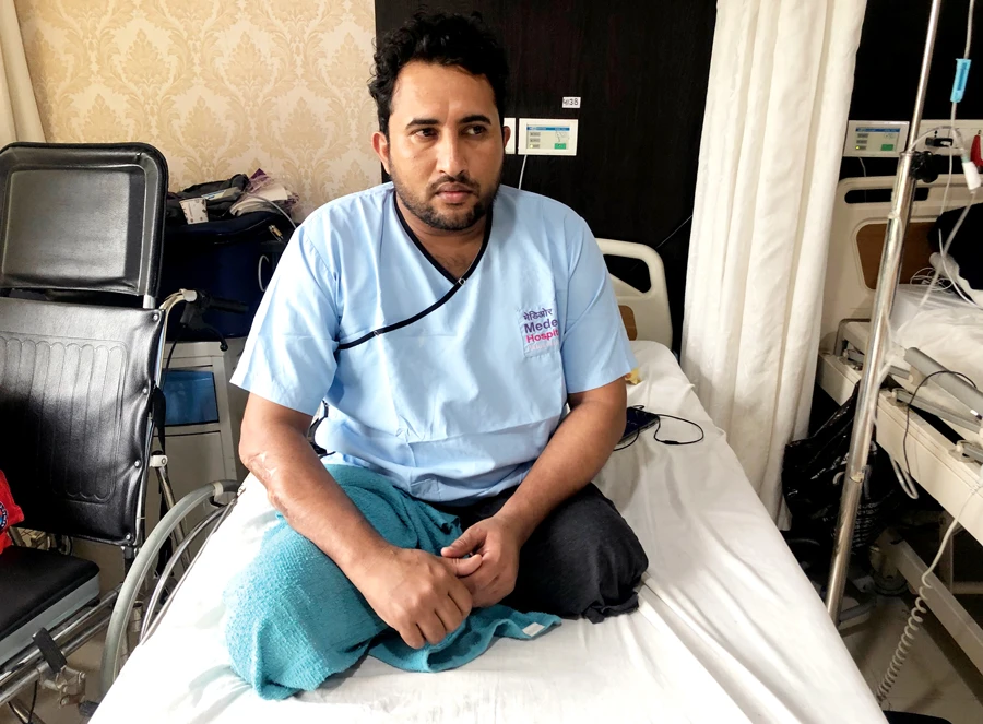 Mansoor Ali Mastor, 28, from Hodeidah, Yemen, who lost both his legs to a landmine blast, being treated in Delhi for four months. (AN photo by Sanjay Kumar)