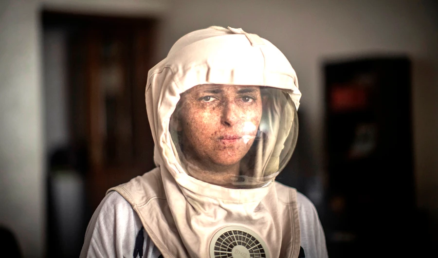 Moroccans struggle with skin disorder