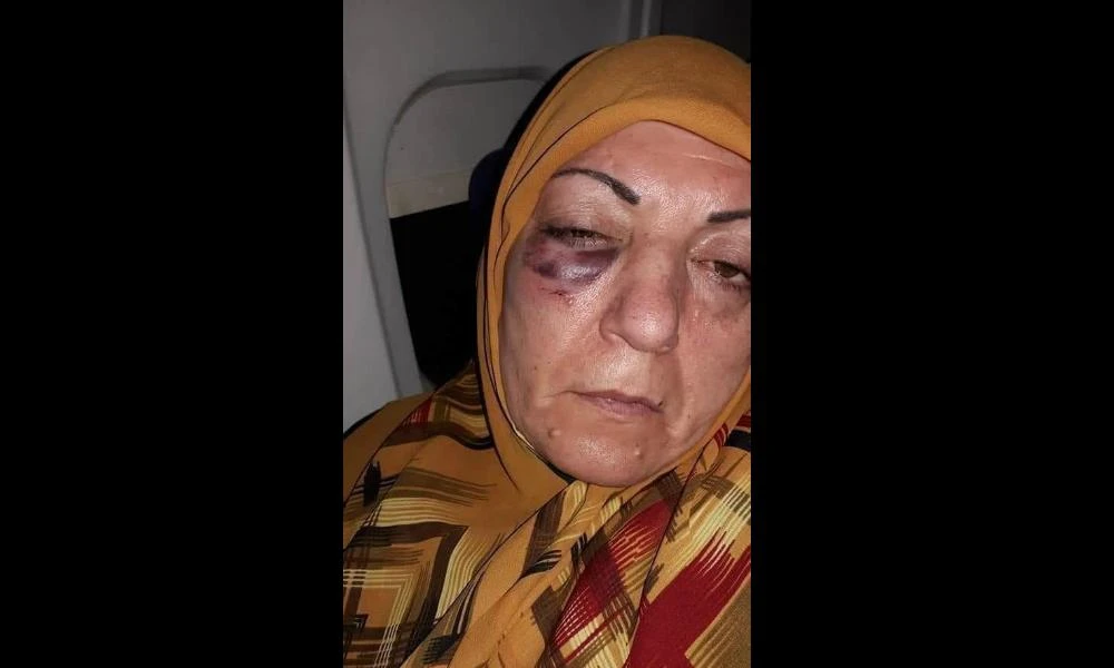 The woman who claims she was beaten by a security officer at an Iranian airport. (Photo courtesy: Social media)