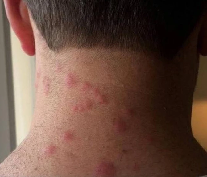 Trump says ‘no bedbugs’ at resort he offered for next G7 summit