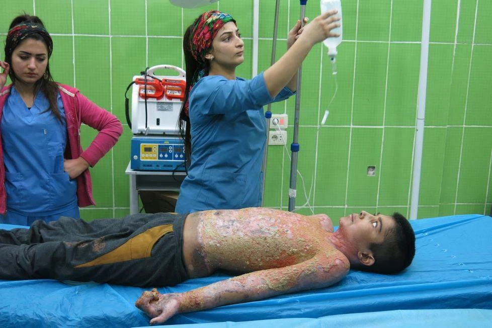 Turkey accused of using illegal phosphorus munitions in Syria