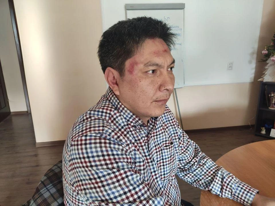 Kyrgyz journalist ‘beaten for reporting on corruption’