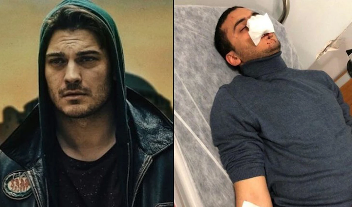 Egyptian stunt double of Turkish actor hospitalized after hate attack in Istanbul
