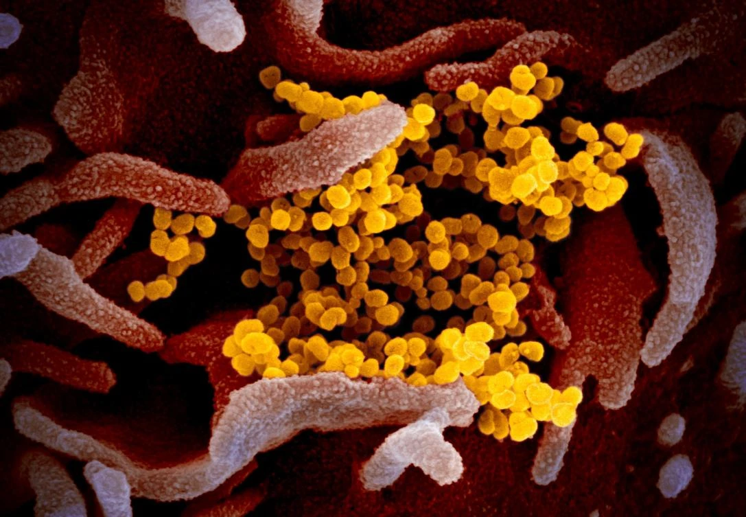 UAE has so far announced 11 confirmed cases of coronavirus, three of them have fully recovered. (NIAID-RML)