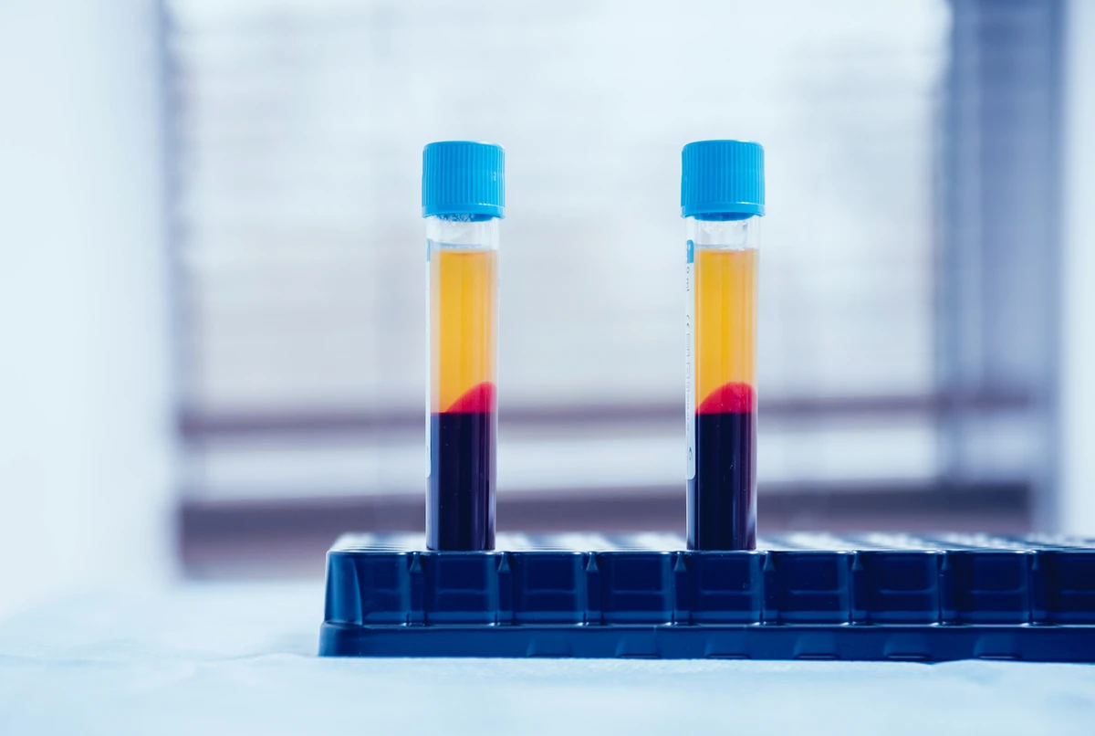 Dubai Health Authority to start treating coronavirus patients with blood plasma