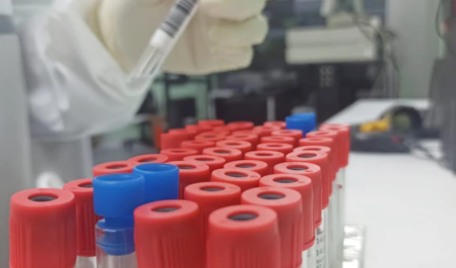 Vials with samples are seen at the Public Health Reference Laboratory testing for coronavirus on April 23. (AN photo/Natasha Zia)