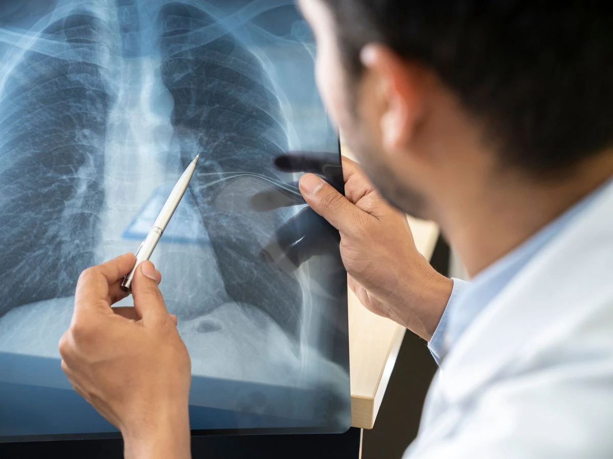 COVID-19 may permanently damage lungs, brain: Experts