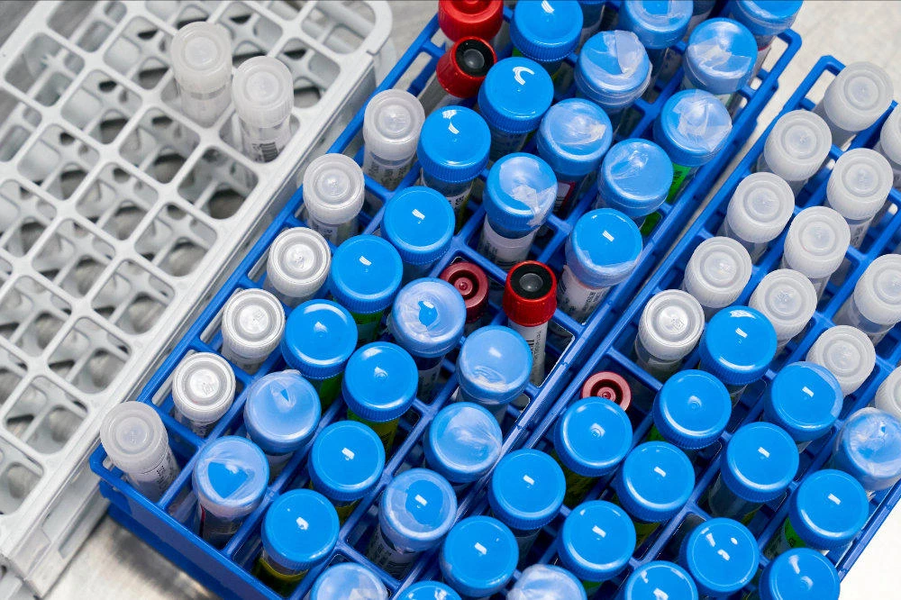 Samples are logged at RealTime Laboratories before testing for the coronavirus disease (COVID-19) in Carrollton, Texas on une 24, 2020. (REUTERS/Cooper Neill/File Photo)