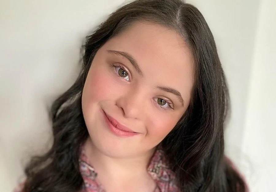 Gucci Beauty’s newest face is a teen with Down syndrome