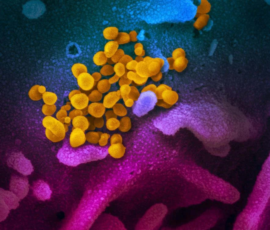 A new, more infectious mutation of coronavirus is now the most common strain, researchers have warned. (File/AFP)