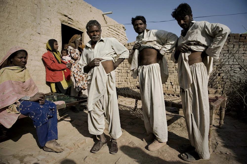 Pakistan Mohamed Ijaz, 25, (2R), displays his scar along with brother Mohamed Riiz, 22, (R), and father Karm Ali, 65, (2L), as his wife Farzana Ijaz, 20, (L), looks on outside his house at a brick factory in Rawalpindi on the outskirts of capital Islamabad on November 18, 2009. (AFP/File Photo)