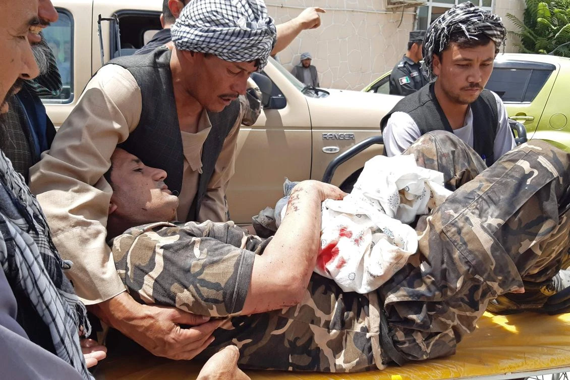 A wounded personnel of National Directorate of Security is brought to a hospital after a car bomb exploded in Aybak of Samangan province, Afghanistan. (AFP)