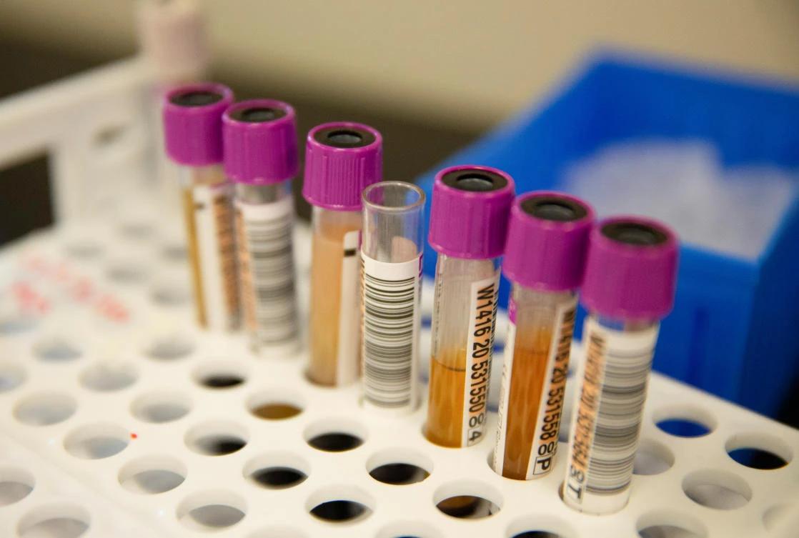 Convalescent plasma samples in vials are seen before being tested for COVID-19 antibodies at the Bloodworks Northwest Laboratory, U.S. (REUTERS)
