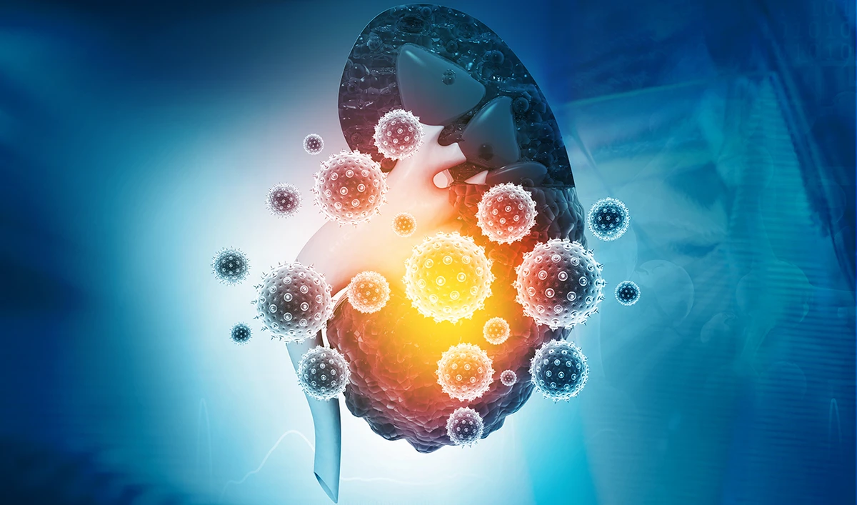 The prevalence of chronic kidney disease (CKD) in the South Asian country had jumped over the past seven years from 9 to 15 percent. (Shutterstock)