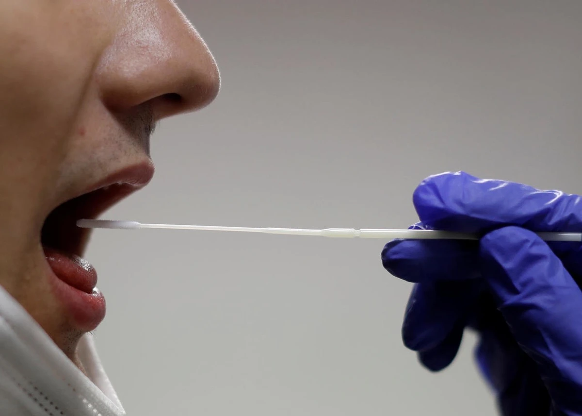 TThe saliva Polymerase-Chain-Reaction test is considered an innovative and reliable test. (WAM)