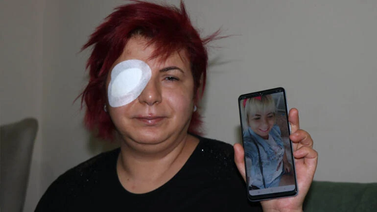 Cilem Kelleci is blind in her right eye and has just 20 percent usage of her left one.
