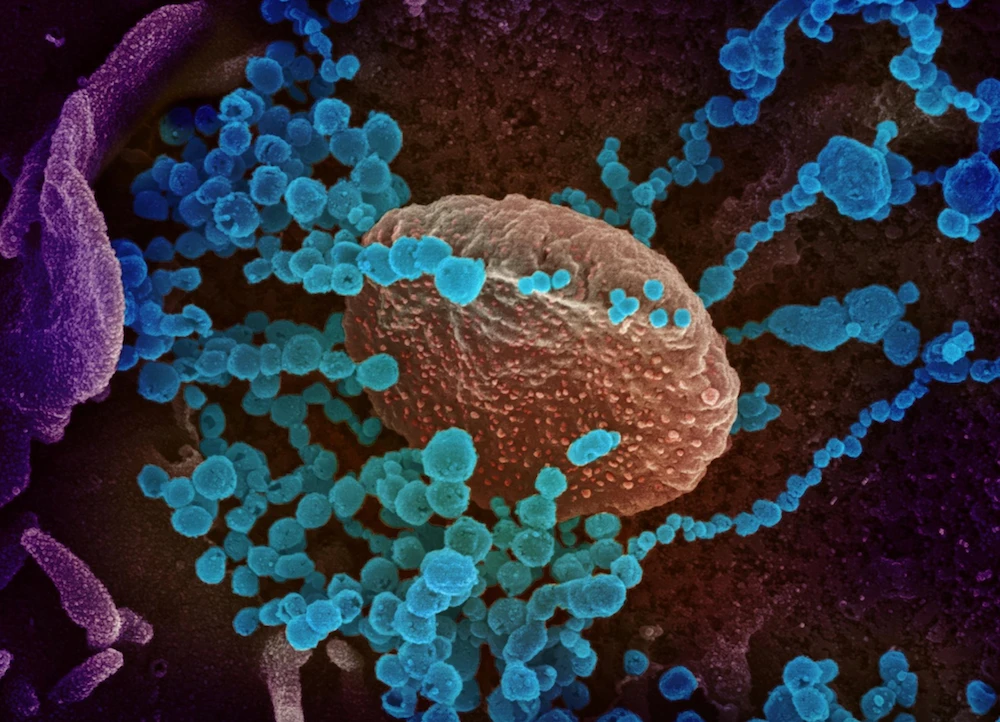 UK variant could be less infectious than first thought