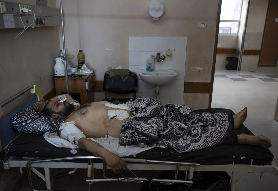 Mohammad Nassar, 31, rests at the Shifa hospital in Gaza City, Thursday, May 13, 2021, where he is receiving treatment for wounds caused by a May 12 Israeli strike that hit while he was driving a motorcycle. (AP/Khalil Hamra)