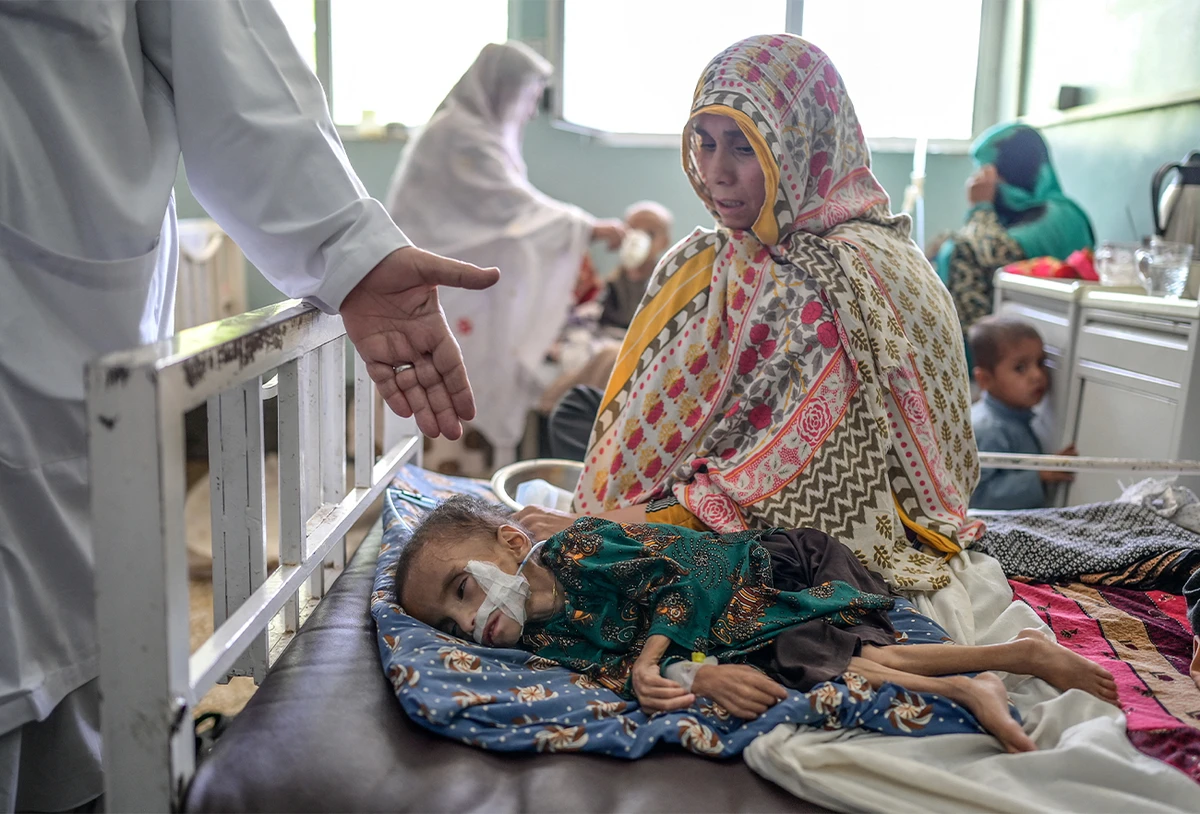 A child suffering from malnutrition receives treatment at the Mirwais hospital in Kandahar, Afghanistan, on September 27, 2021. (AFP)