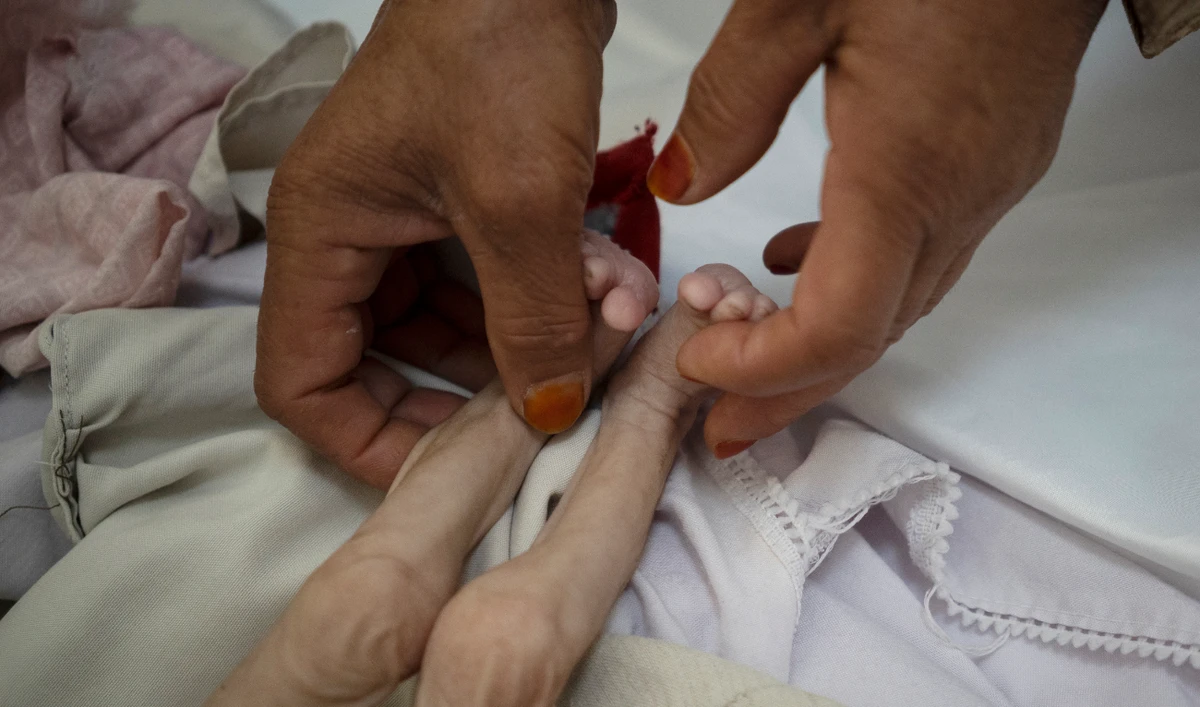 Increases in acute hunger are also being seen in Ethiopia, Haiti, Somalia, Angola, Kenya, and Burundi, the Rome-based agency said. (AP)