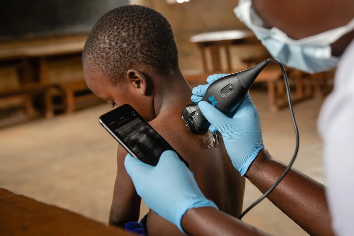 ALJ Health, Butterfly Network join hands to distribute innovative ultrasound device