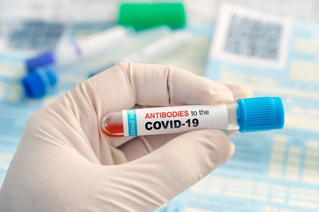 Spain's top research institution reached a licensing deal that paves the way for its Covid-19 antibody test to be produced more cheaply in developing countries. (Shutterstock)