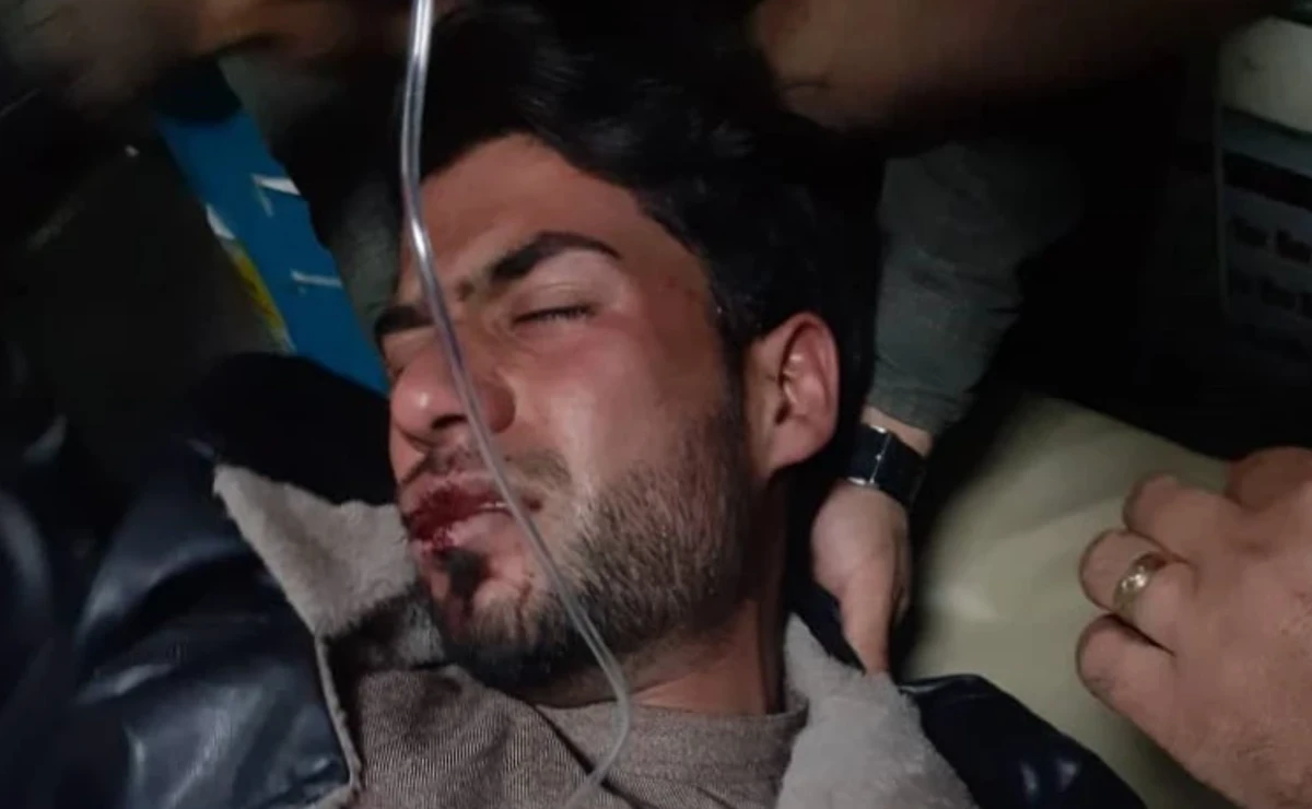 Rights watchdog condemns assault of Afghan journalist