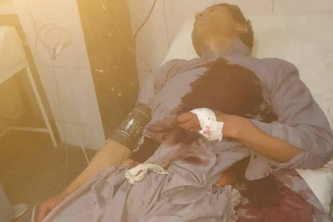 Rights group condemns attack on Afghan journalist