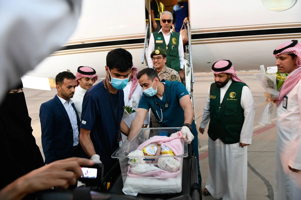 The twins were transferred upon their arrival to King Abdullah Specialized Children’s Hospital (KASCH) to study their condition and consider the possibility of conducting an operation to separate them. (Supplied)