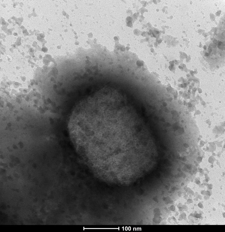Health authorities in Europe, North America, Israel and Australia have identified more than 100 cases of monkeypox in recent days. (AP)
