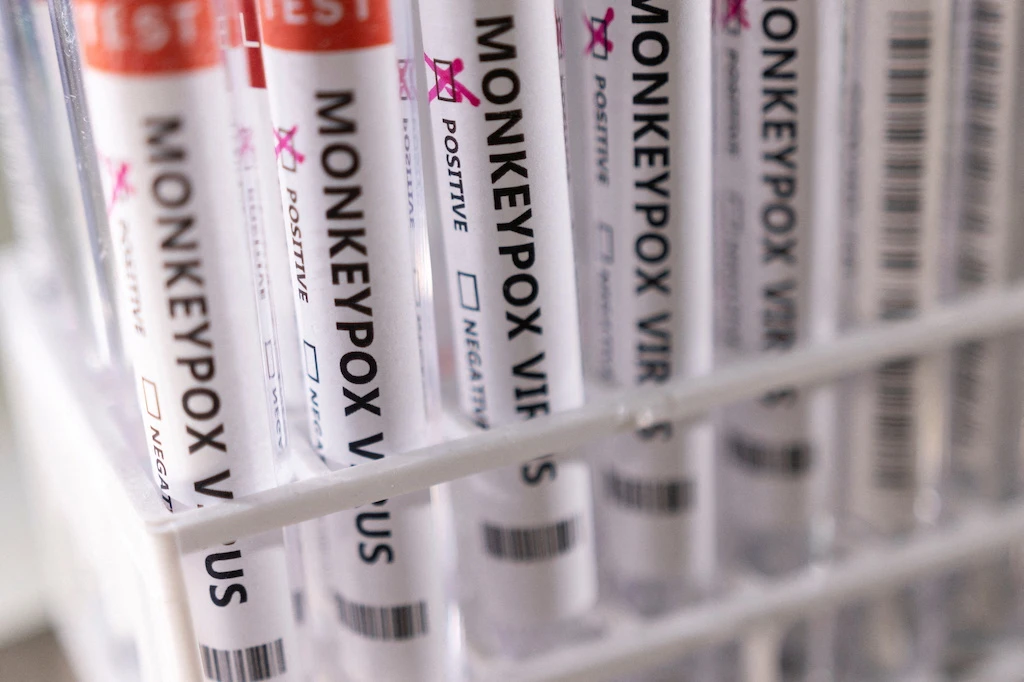 UAE reports three more monkeypox cases