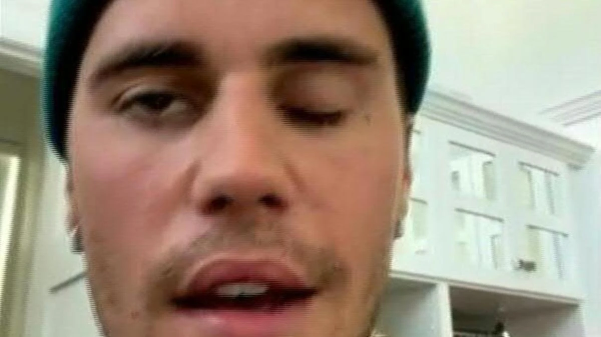 Justin Bieber reveals rare disorder behind facial paralysis