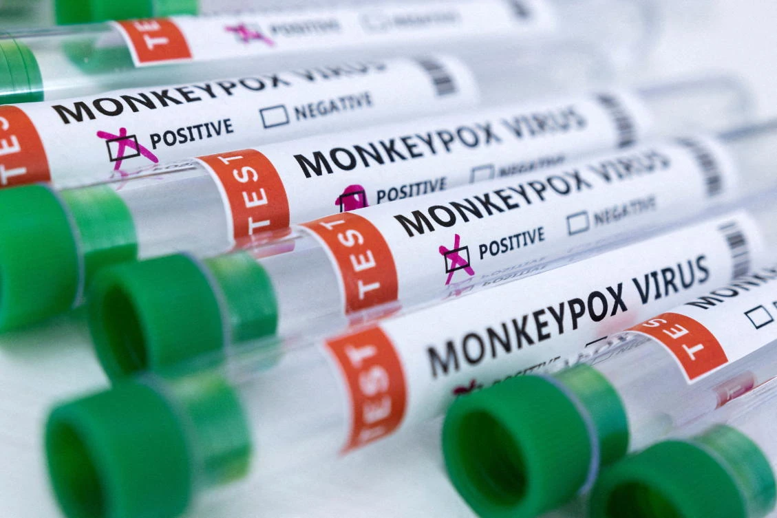 World Health Organization to hold emergency meeting this week to determine whether to classify global outbreak as public health emergency. (REUTERS)