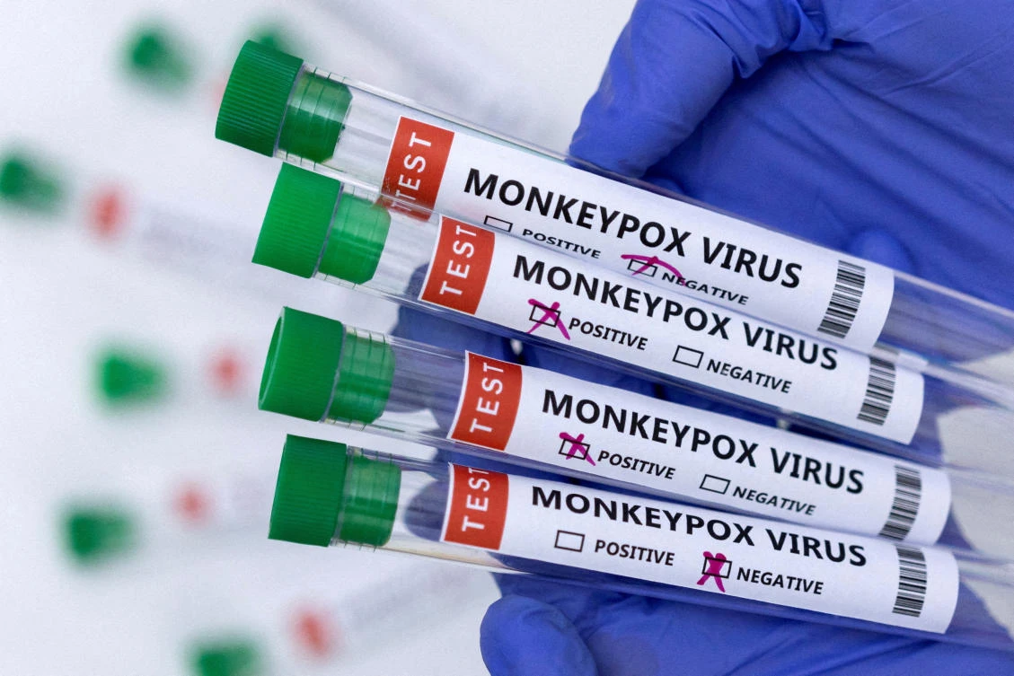 FILE PHOTO: Test tubes labelled “Monkeypox virus positive and negative” are seen in this illustration taken on May 23, 2022. (Reuters)