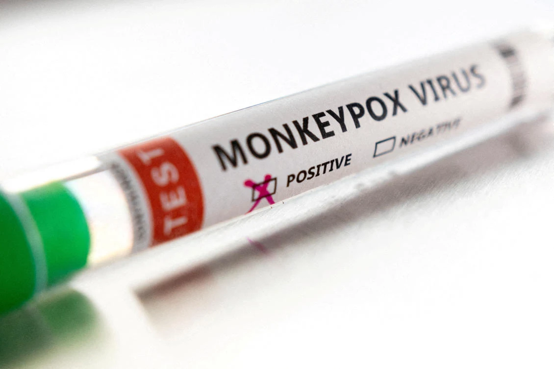 More than 40 countries where monkeypox is not endemic have reported outbreaks of the viral disease as confirmed cases exceed 3,000. (REUTERS)