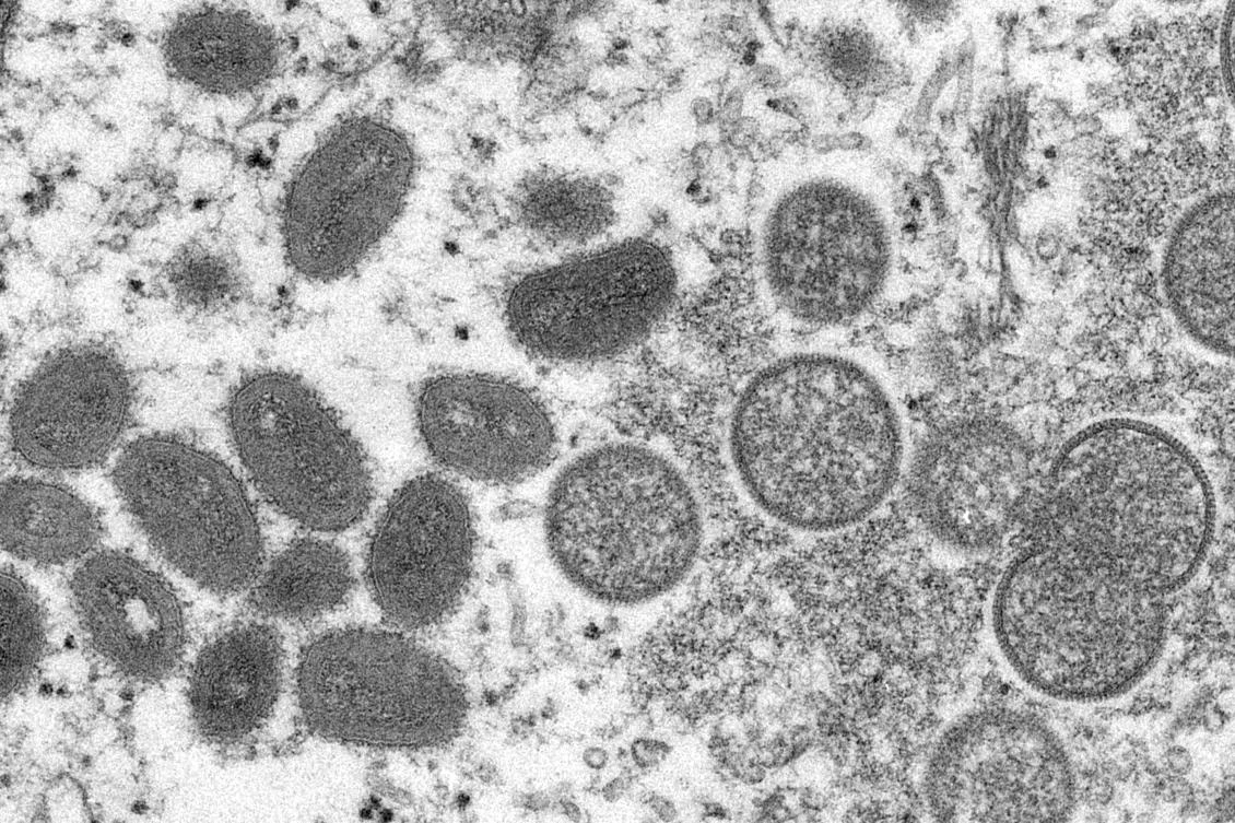 The disease has a fatality rate of between one and 10 percent depending on the variant — there are two — in endemic countries. (CDC via AP)