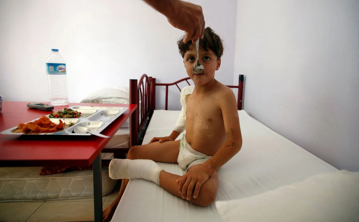 An injured Syrian refugee boy, is fed by a nurse as he undergoes rehabilitation at a post traumatic care centre in Hatay. (File/Reuters)