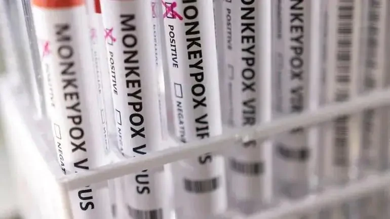 Indian capital reports first monkeypox case as WHO declares global emergency