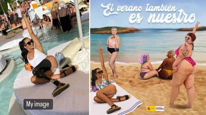 Spain’s Ministry of Equality edits out model’s prosthetic leg in beach ad